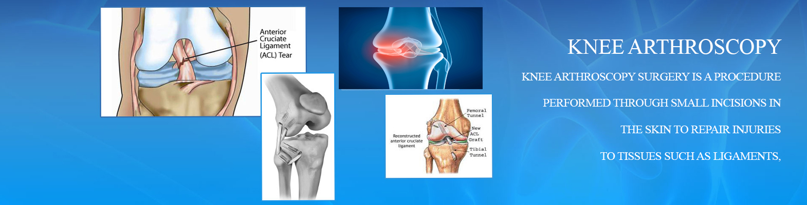 Joint Surgeon in jaipur